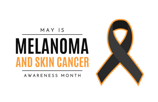 Melanoma